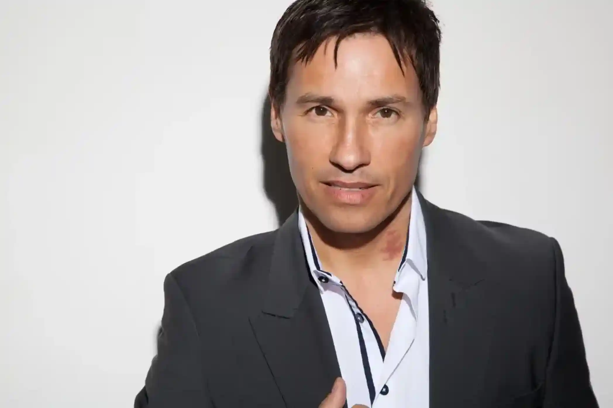A man in a dark suit and white shirt is posing against a plain white background. He has short, dark hair and a confident expression, with a visible mark on his neck.